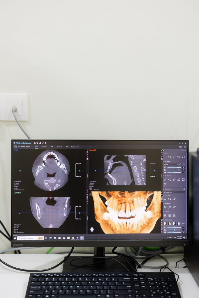 3D dental imaging used for implant planning at Mori Dental