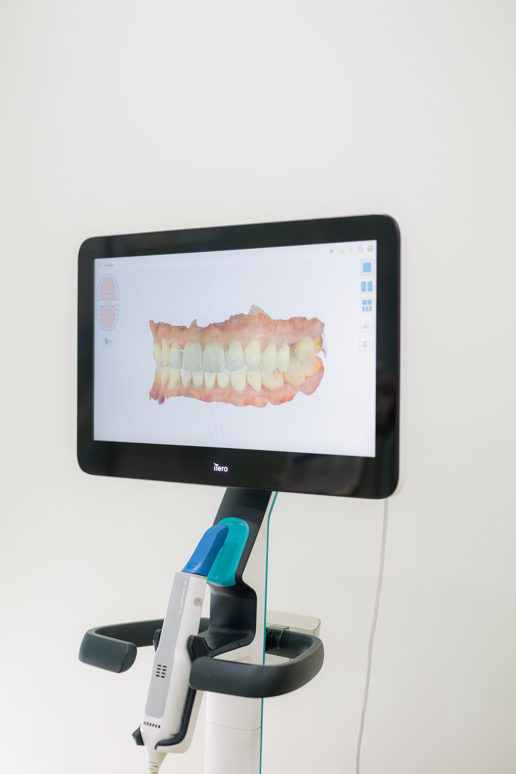 iTero digital scanner used for smile planning at Mori Dental